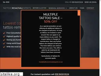 tattooremovalexperts.co.uk
