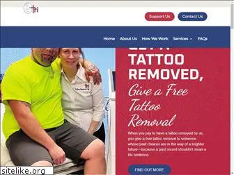 tattooremovalink.org