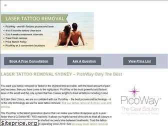 tattooremovalspecialist.com.au