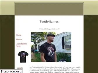 teeth4james.googlepages.com