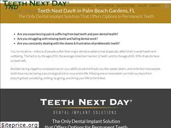 teethnextday.com