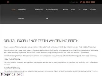 teethwhiteningperth.net.au