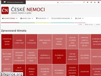tema.ceskenemoci.cz