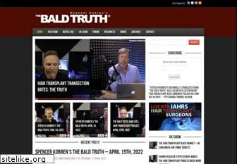 thebaldtruth.com