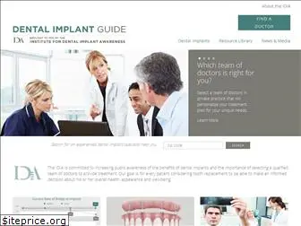 thedentalimplantguide.org