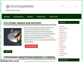 thrombophlebitis.ru