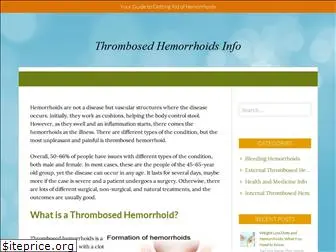 thrombosedhemorrhoidsinfo.com