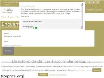 todoimplantecapilar.com