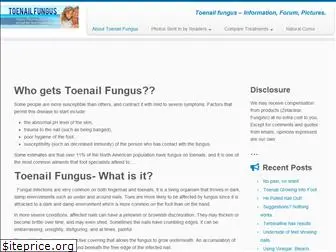 toenailfungus.org