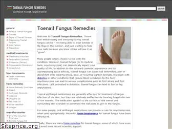 toenailfungusremedies.com