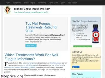 toenailfungustreatments.com