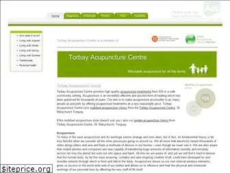 torbayacupuncture.co.uk