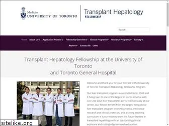 torontotxhepatologyfellowship.com