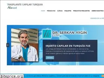 trasplantecapilarturquia.com