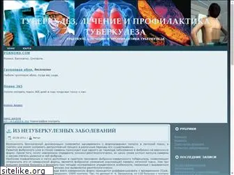 tuberkuleznik.ru