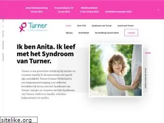 turnercontact.nl