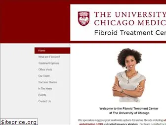 ucfibroids.com