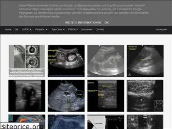 ultrasound-cases.blogspot.com