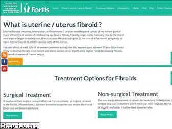uterusfibroidtreatment.com