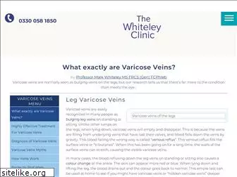 varicose-veins.co.uk