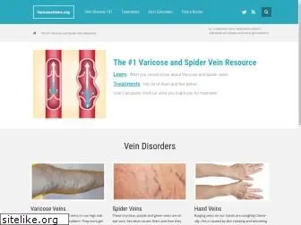 varicoseveins.org