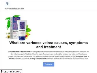 varicoseveinscauses.com