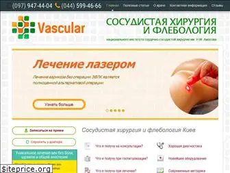 vascular.kiev.ua