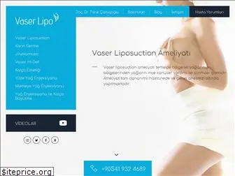 vaserlipo.com.tr