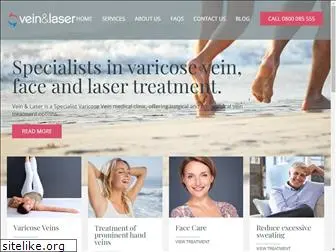 veinandlaser.co.nz