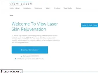 viewlaser.com