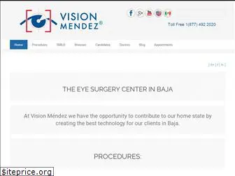 visionmendez.com