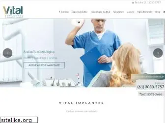 vitalimplantes.com.br