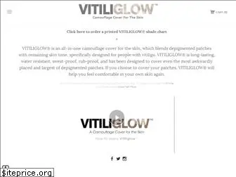 vitiliglow.co.uk