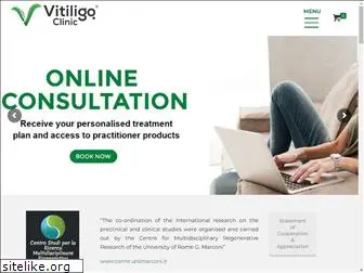 vitiligo.clinic
