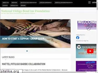 vitiligobond.org