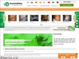 vitiligoleucoderma.com