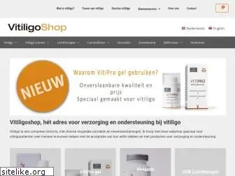 vitiligoshop.nl