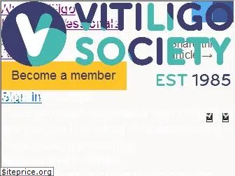 vitiligosociety.org.uk