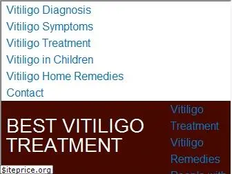 vitiligotreatmentinfo.com