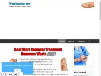 wart-removal-now.com