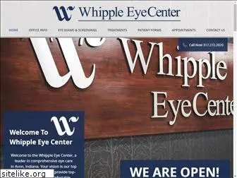 whippleeyecenter.com