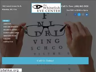 whitefisheyecenter.com
