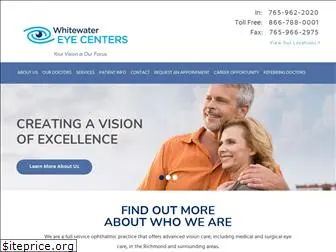 whitewatereyecenters.com