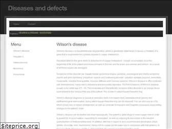 wilsons-disease.org.uk