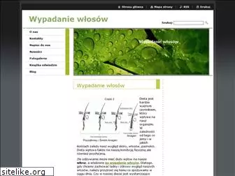 wypadaniewlosow.webnode.com
