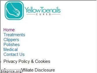 yellowtoenailscured.com