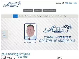 yumahearing.com