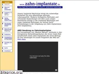 zahn-implantate.de