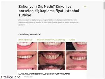 zirkonyumdisnedir.com